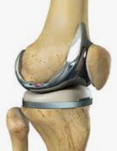 knee1